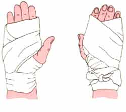 Precauções ao usar bandagem em entorses de punho